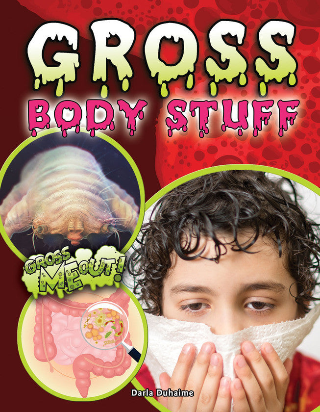 2017 - Gross Body Stuff (Paperback)